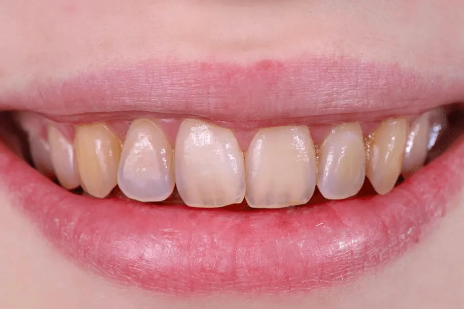 25557 healthy habits teeth