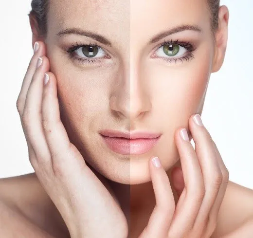 25580 face whitening overview