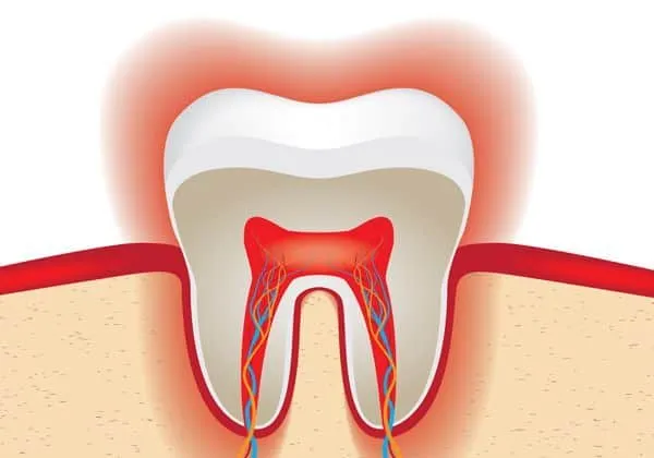 25590 fluoride treatment