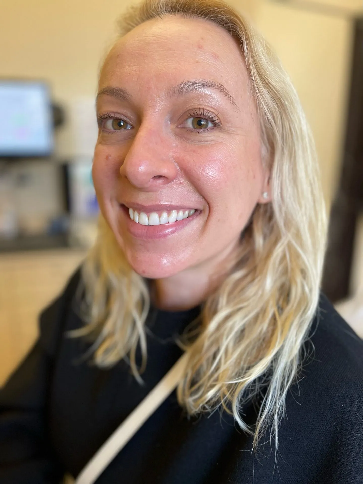 25591 avoiding staining foods