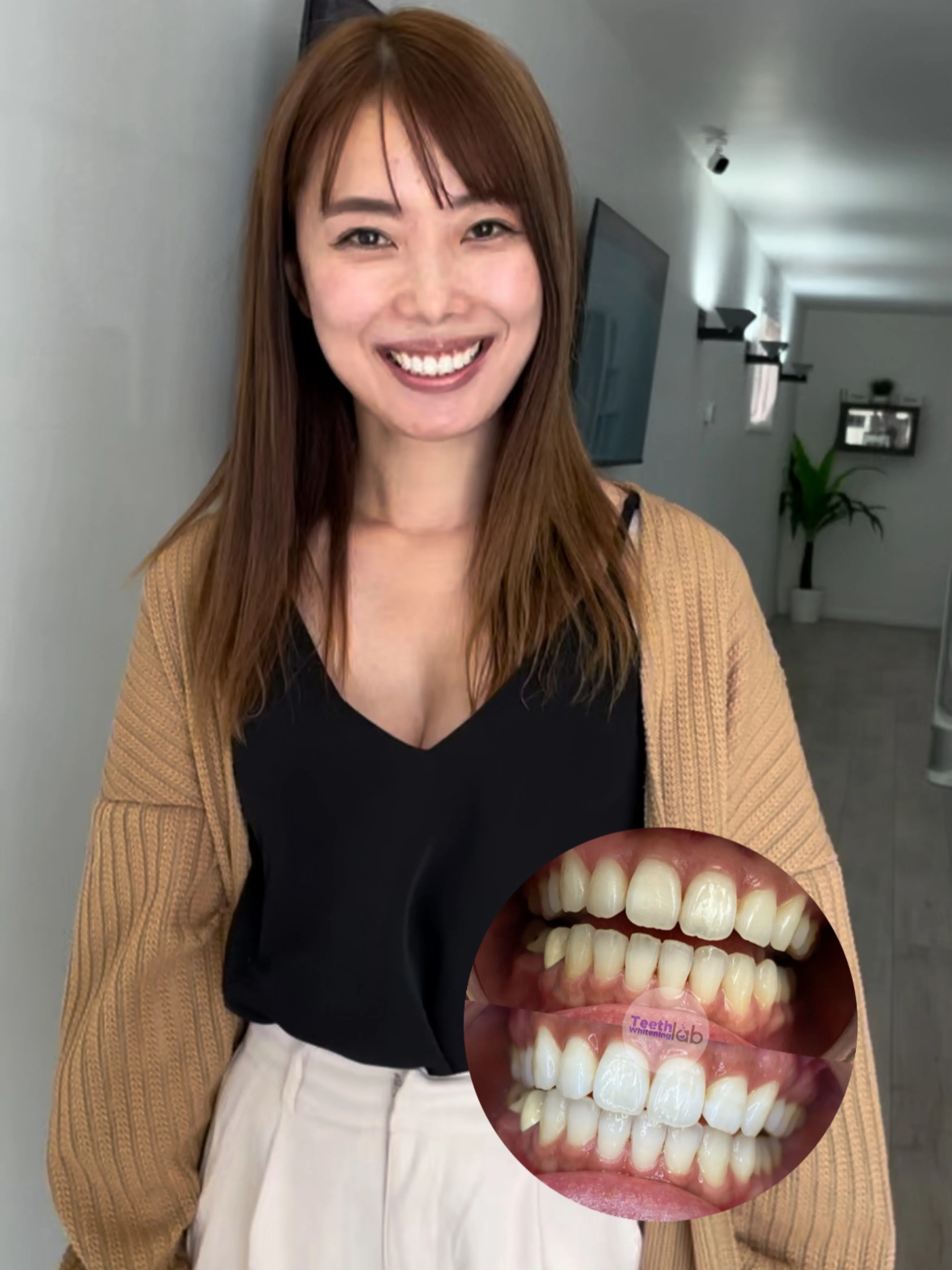 25593 teeth whitening long island image5