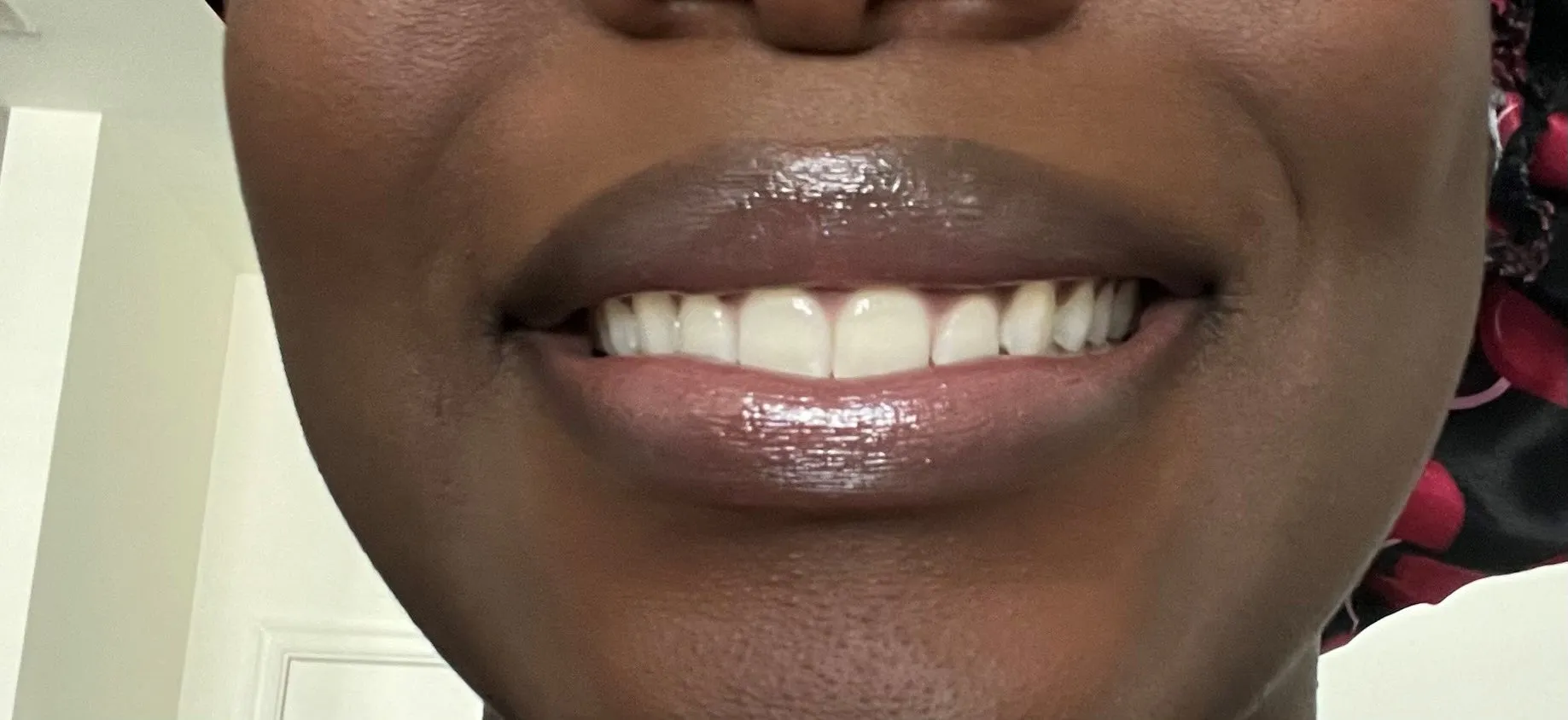 25599 whitening smile