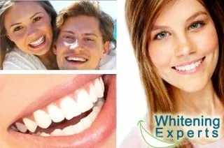 /img/25605-teeth-whitening-alternatives.webp