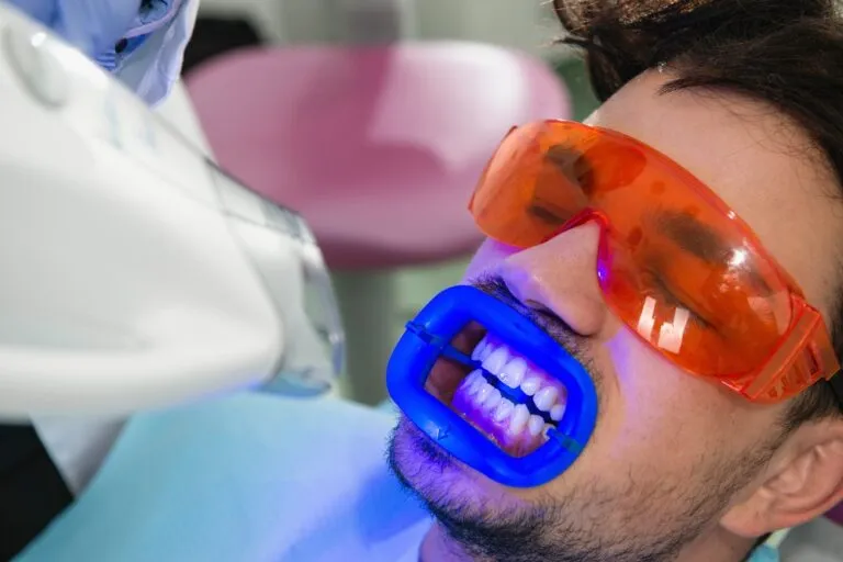 25606 laser teeth whitening