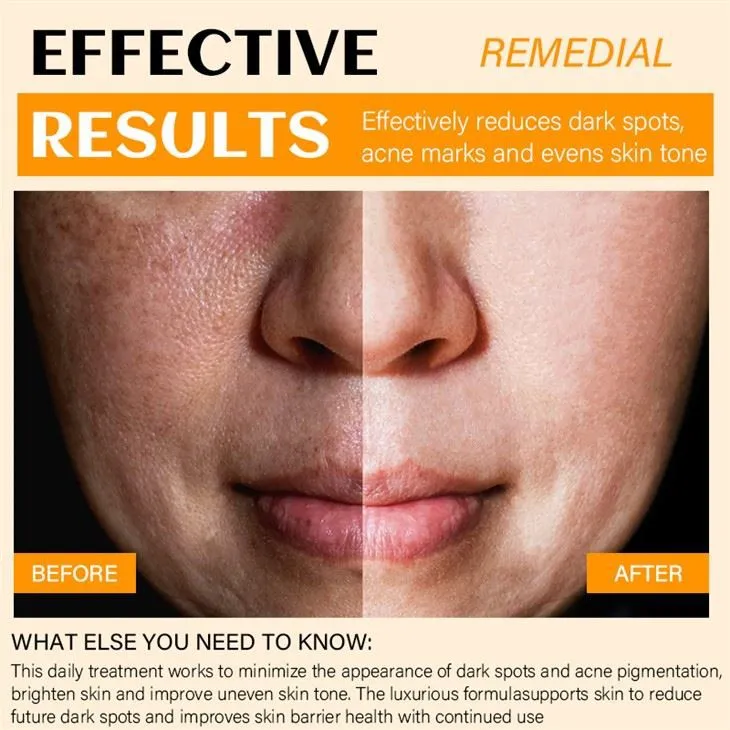 25608 turmeric face mask