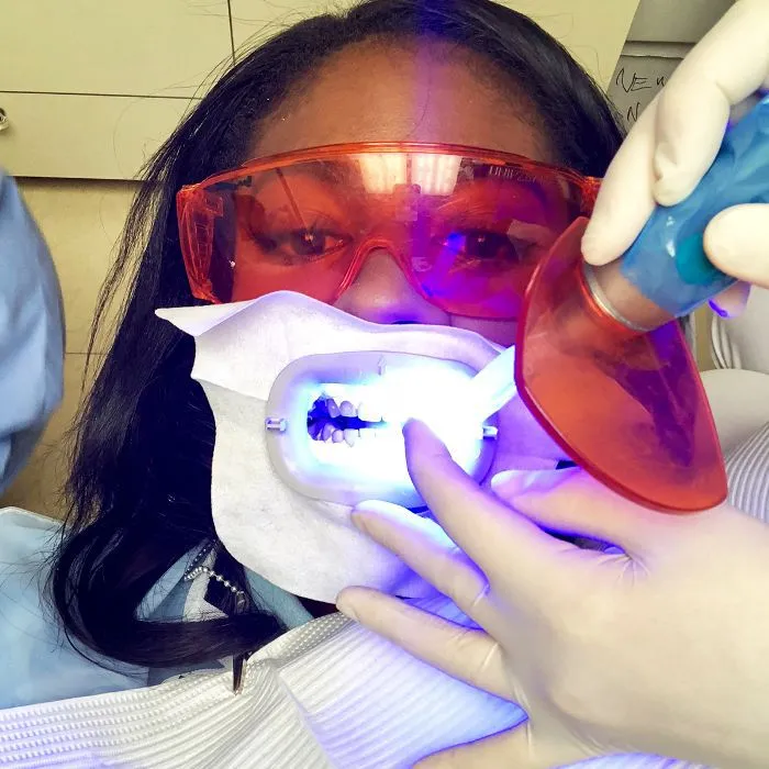 25615 teeth sensitivity