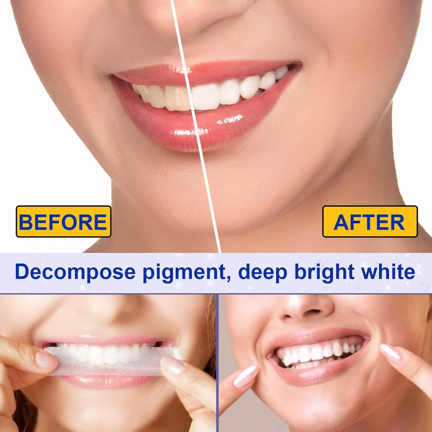 25619 teeth whitening strips application