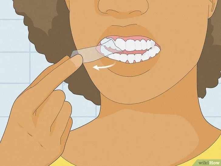 25619 teeth whitening strips smile