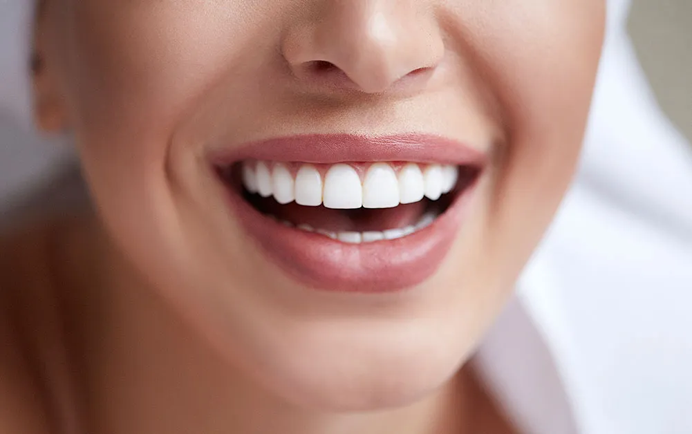 25620 teeth whitening whitby 3