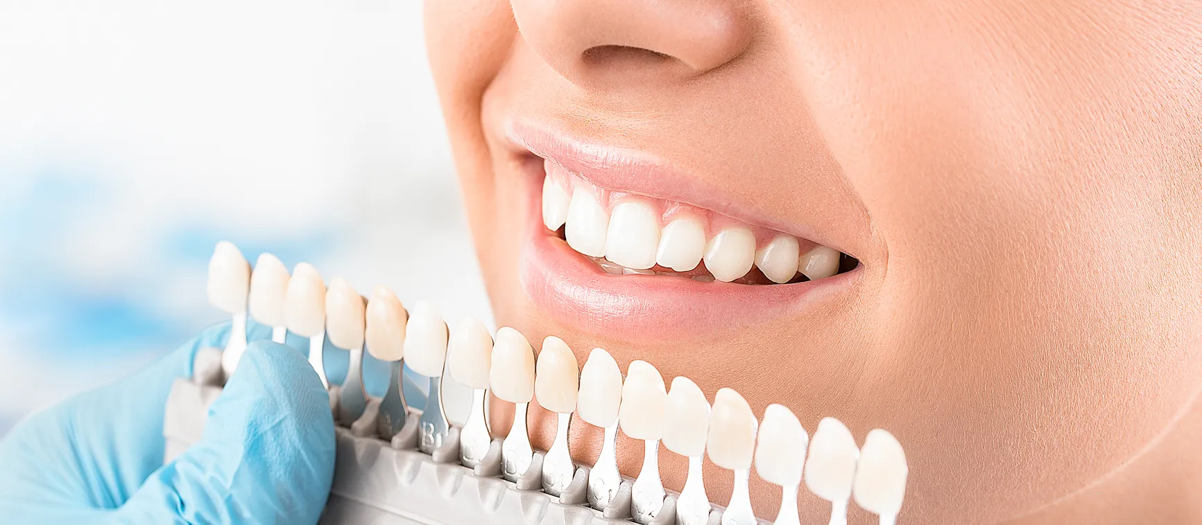 /img/25620-teeth-whitening-whitby-7.webp