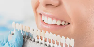 /img/25620-teeth-whitening-whitby-7.webp
