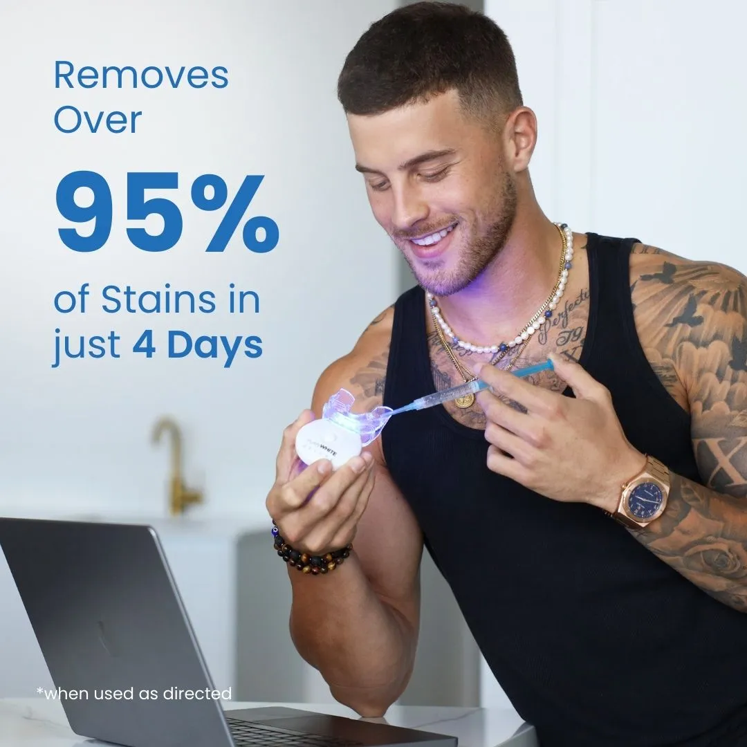 25631 teeth whitening stains
